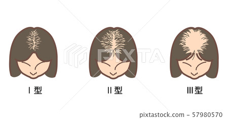 Classification of female androgenetic alopecia 2 57980570