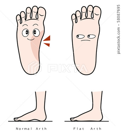 Flat feet Flat feet 58087695