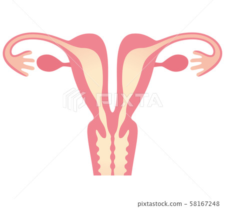 子宮畸形子宮重複 子宮畸形子宮重複 58167248