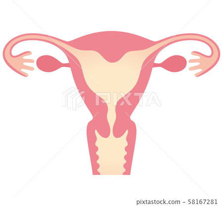 子宮畸形弓狀子宮 子宮畸形弓狀子宮 58167281
