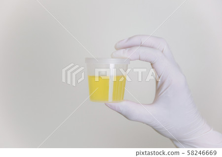 Urine tests sample analysis for doctor taking test tube with Urine tests sample analysis for doctor taking test tube with 58246669