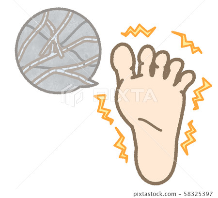 運動員的腳癢 58325397