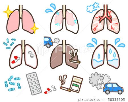 各種肺部疾病 58335305