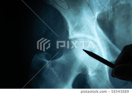 X ray film with doctor's hand to examine 58343889