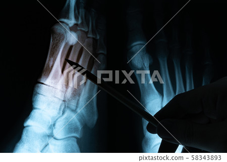 X-ray film with doctor's hand 58343893