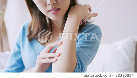 woman has dry skin 58386894