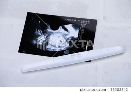 懷孕妊娠試驗迴聲照片 懷孕妊娠試驗迴聲照片 58388842