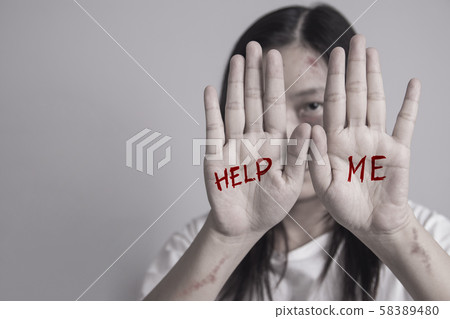 stop violence against women campaign. Asia woman with bruise on arms and face raised her hand for dissuade, hand write the word help me. 58389480