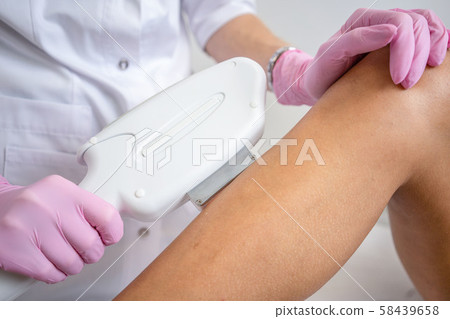 Laser hair removal on women's legs . white background close up 58439658