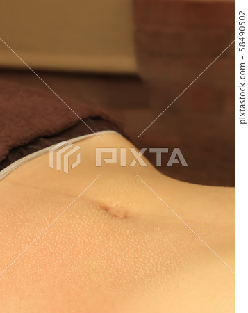 After treatment Abdomen Sweat image 58490502
