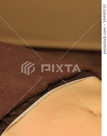 After treatment Abdomen Sweat image After treatment Abdomen Sweat image 58490510