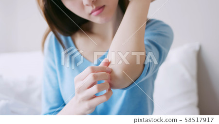 woman has dry skin 58517917