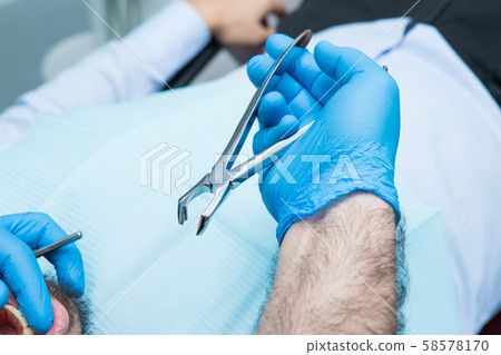 Surgery. Dentist's hand with tooth extraction Surgery. Dentist's hand with tooth extraction 58578170