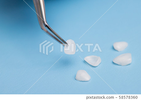Dentist holds a veneer with tweezers against a 58578360