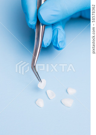 Dentist holds a veneer with tweezers against a Dentist holds a veneer with tweezers against a 58578362