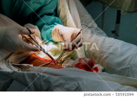 Preparation of surgeons in operating room with Preparation of surgeons in operating room with 58591094