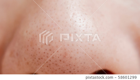 blackheads on woman nose blackheads on woman nose 58601299