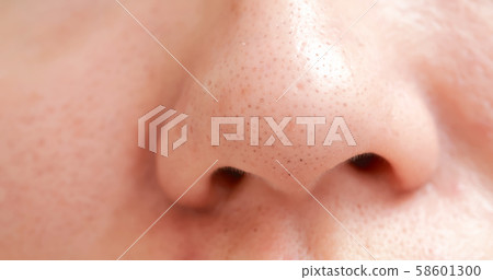 blackheads on woman nose blackheads on woman nose 58601300