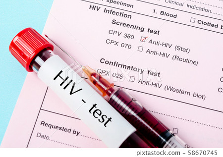 Sample blood in blood tube with HIV test label 58670745
