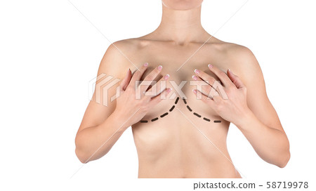 Female breasts marked for plastic operation, isolated on white. Woman cover her bust by her hands. 58719978