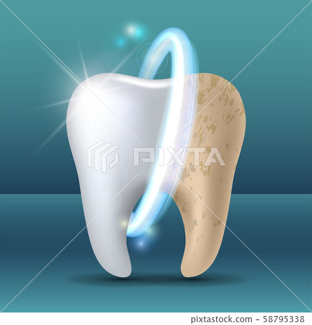 Clean and dirty tooth before and after whitening 58795338