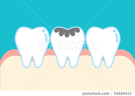 可愛的卡通植入牙說明 58880422