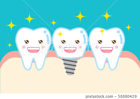 可愛的卡通植入牙 58880429