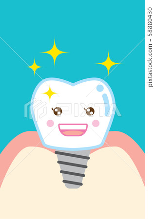 可愛的卡通植入牙 58880430