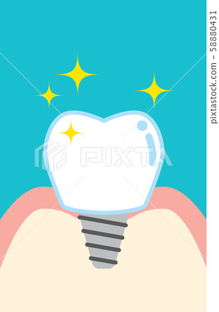 Cute cartoon implant tooth 58880431