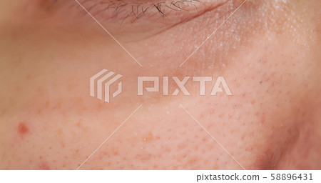 asian woman with dark circle asian woman with dark circle 58896431