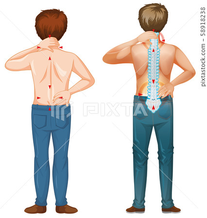 Man with back pain on white background - Stock Illustration [58918238 ...