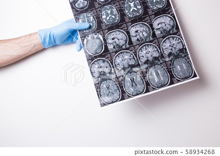 MRI image on a white background. Doctor's gloved hand holds a snapshot. 58934268