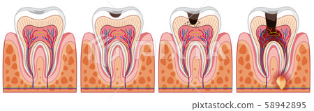 A Set of Human Tooth A Set of Human Tooth 58942895