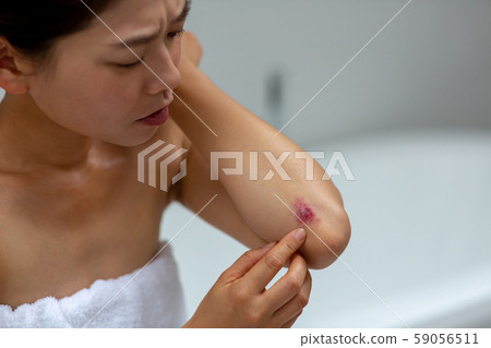 scar, scratch, female 59056511