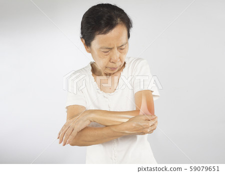 elbow, pain, arthritis 59079651