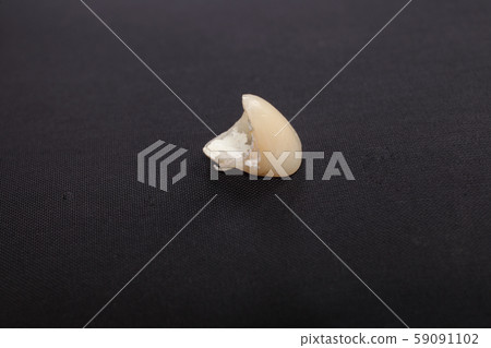 Dentures, temporary teeth Dentures, temporary teeth 59091102