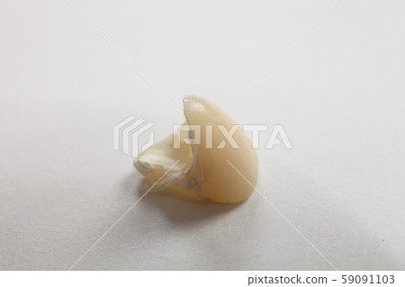 Dentures, temporary teeth 59091103