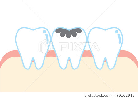 可愛的卡通腐爛的牙齒說明 59102913