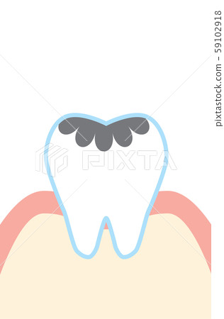 可愛的卡通腐爛的牙齒說明 59102918