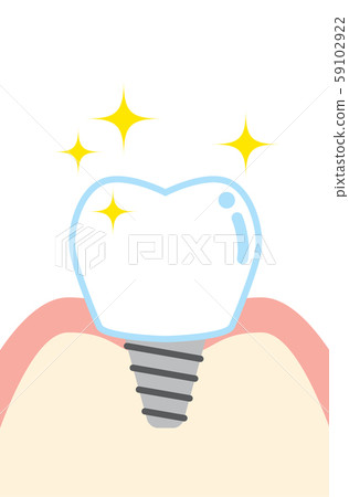 可愛的卡通插圖implan 59102922