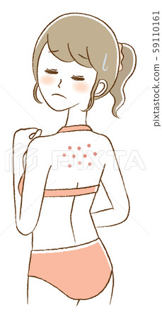 背部痤瘡，擔心的女人插圖 59110161