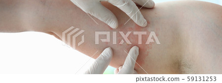 Male doctor in white protective gloves examing patient 59131253