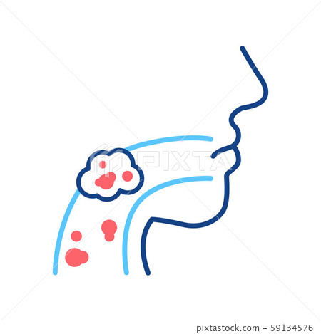 Laryngeal cancer line color icon. Human organ concept. Malignant neoplasm. Sign for web page, mobile Laryngeal cancer line color icon. Human organ concept. Malignant neoplasm. Sign for web page, mobile 59134576
