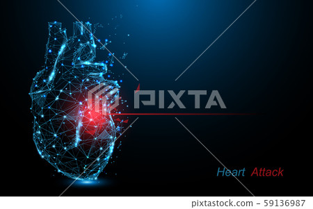 Human heart attack. Heart disease form lines, triangles and particle style design Human heart attack. Heart disease form lines, triangles and particle style design 59136987