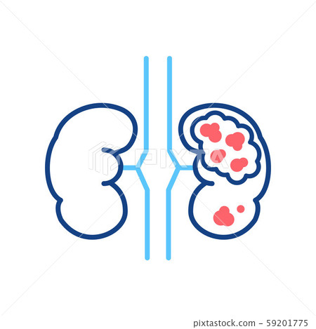 Kidney cancer line color icon. Human organ Kidney cancer line color icon. Human organ 59201775