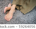 Closeup of barefeet woman with painful toes -  Medical condition called bunions or hammer toes (Hallux valgus) painful and suffering. Middle aged woman's health concept - feet problem. 59264056