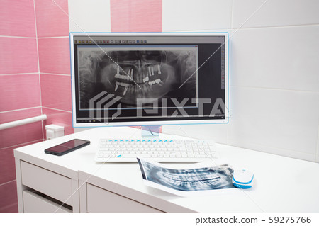 An x-ray on the monitor at dental clinic 59275766