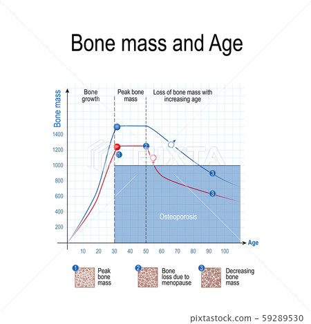 Bone mass for male and female. Age and osteoporosis. Chart. healthy lifestyle. Vector illustration for educational, science and medical use 59289530