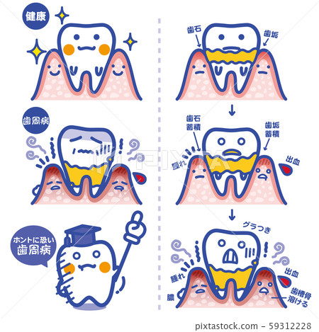 Seikatsu pickup / periodontal disease (blue ruled line) Seikatsu pickup / periodontal disease (blue ruled line) 59312228