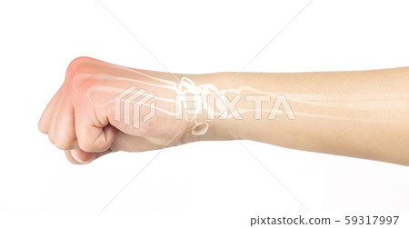 wrist bones injury white background wrist pain wrist bones injury white background wrist pain 59317997